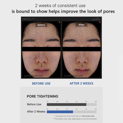 Medicube Zero Pore Pad 2.0 | Exfoliating AHA BHA PHA Toner Pads